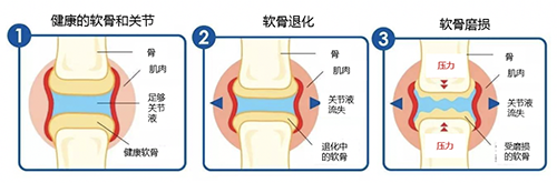 益节氨糖钙片服用方法